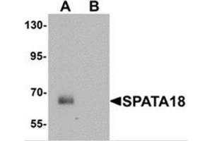 Image no. 1 for anti-Spermatogenesis Associated 18 (SPATA18) (N-Term) antibody (ABIN1450101)