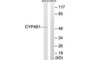 Image no. 1 for anti-Cytochrome P450, Family 4, Subfamily B, Polypeptide 1 (CYP4B1) (AA 141-190) antibody (ABIN1534398)