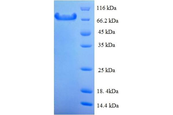 CAPN1 Protein (AA 1-713, full length) (His tag)