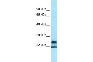 anti-YrdC Domain Containing (YRDC) (Middle Region) antibody