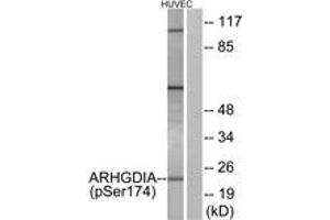 Western blot analysis of extracts from HuvEc cells treated with EGF 200ng/ml 30', using ARHGDIA (Phospho-Ser174) Antibody.