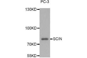 Image no. 1 for anti-Scinderin (SCIN) antibody (ABIN1682626)