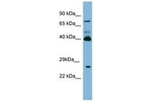 Image no. 1 for anti-Transglutaminase 3 (E Polypeptide, Protein-Glutamine-gamma-Glutamyltransferase) (TGM3) (N-Term) antibody (ABIN6741686)
