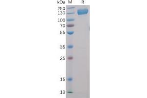 Image no. 1 for CD22 Molecule (CD22) protein (Fc Tag,His tag) (ABIN6961078)