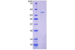 Image no. 1 for Myomesin 2 (MYOM2) (AA 1130-1434) protein (His tag) (ABIN6237216)