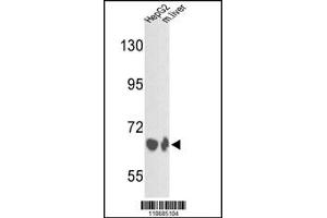 Western Blotting (WB) image for anti-Complement Factor B (CFB) antibody (ABIN2158221)