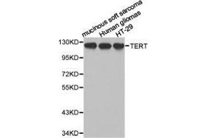 Image no. 3 for anti-Telomerase Reverse Transcriptase (TERT) antibody (ABIN1875058)