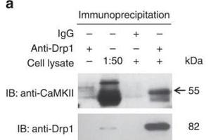 Image no. 7 for anti-Calcium/calmodulin-Dependent Protein Kinase II delta (CAMK2D) (Center) antibody (ABIN2856806)