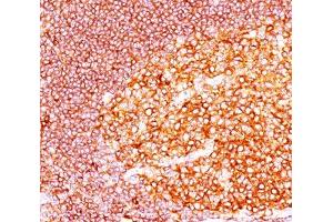 Image no. 1 for anti-Mucosa Associated Lymphoid Tissue Lymphoma Translocation Gene 1 (MALT1) (AA 701-808) antibody (ABIN3025292)