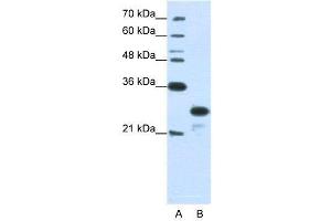 Image no. 3 for anti-Acidic (Leucine-Rich) Nuclear phosphoprotein 32 Family, Member A (ANP32A) (N-Term) antibody (ABIN2778668)