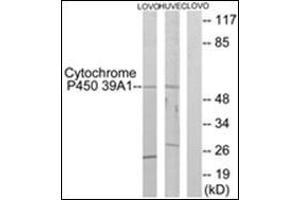 Image no. 3 for anti-Cytochrome P450, Family 39, Subfamily A, Polypeptide 1 (CYP39A1) (C-Term) antibody (ABIN951785)