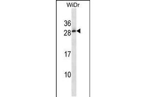 Image no. 1 for anti-Testis Expressed 40 (TEX40) (AA 172-200), (C-Term) antibody (ABIN5538397)