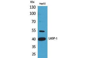 Image no. 1 for anti-LIM and SH3 Protein 1 (LASP1) (Internal Region) antibody (ABIN3187767)