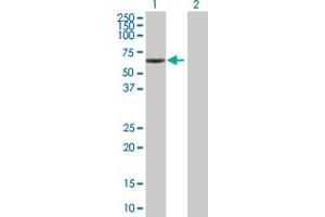 Western Blot analysis of MSL3 expression in transfected 293T cell line by MSL3 MaxPab polyclonal antibody.