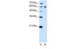 Image no. 1 for anti-Deltex Homolog 2 (DTX2) (AA 454-503) antibody (ABIN6739165)