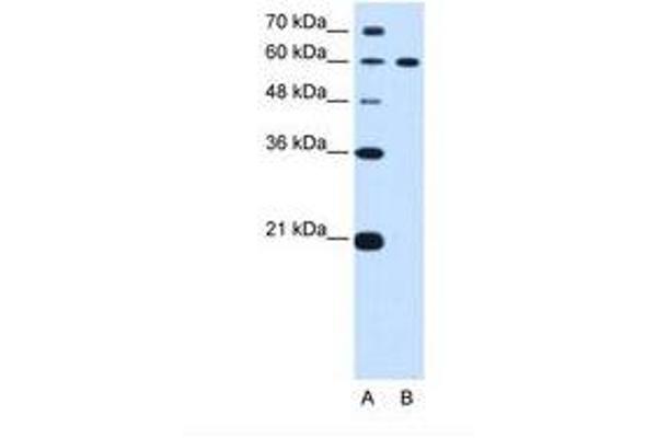 DTX2 Antikörper  (AA 454-503)