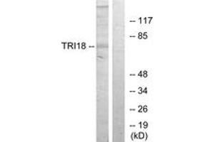 anti-Midline 1 (MID1) (AA 71-120) antibody