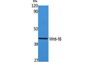 Image no. 1 for anti-Wingless-Type MMTV Integration Site Family, Member 16 (WNT16) (Internal Region) antibody (ABIN3187661)