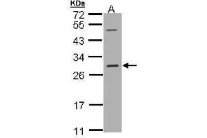 Image no. 1 for anti-V-Ral Simian Leukemia Viral Oncogene Homolog B (Ras Related, GTP Binding Protein) (Ralb) (full length) antibody (ABIN2856651)