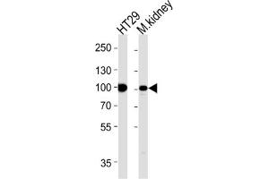 Image no. 1 for anti-Villin 1 (VIL1) antibody (ABIN3002792)
