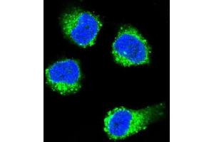 Image no. 2 for anti-Nerve Growth Factor beta (NGFB) antibody (ABIN3003483)