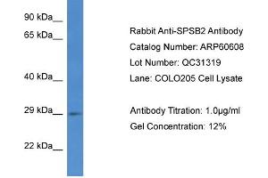 Image no. 1 for anti-SplA/ryanodine Receptor Domain and SOCS Box Containing 2 (SPSB2) (C-Term) antibody (ABIN2788511)