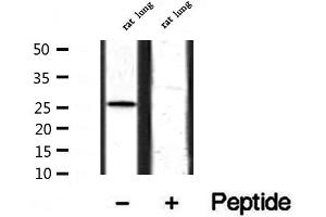 Image no. 3 for anti-A Kinase (PRKA) Interacting Protein 1 (AKIP1) (Internal Region) antibody (ABIN6259539)