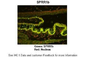 Image no. 1 for anti-Small Proline Rich Protein 1B (SPRR1B) (Middle Region) antibody (ABIN2789544)
