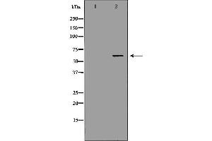 SLC22A6 抗体  (C-Term)