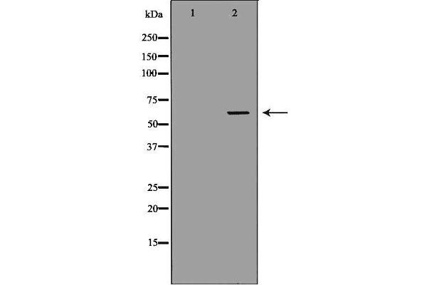 anti-Solute Carrier Family 22 Member 6 (SLC22A6) (C-Term) antibody