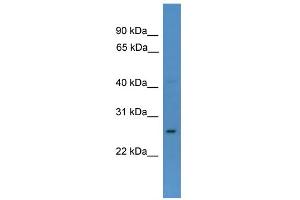 Image no. 1 for anti-Caudal Type Homeobox 1 (CDX1) (N-Term) antibody (ABIN2780382)