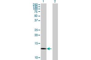 Western Blot analysis of FBXW9 expression in transfected 293T cell line by FBXW9 MaxPab polyclonal antibody.