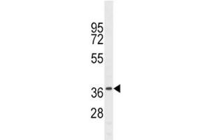 Image no. 3 for anti-NK6 Homeobox 1 (NKX6-1) (AA 285-314) antibody (ABIN3028877)