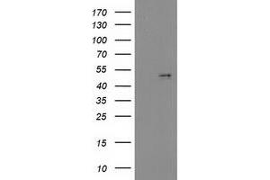 Image no. 2 for anti-Platelet Derived Growth Factor D (PDGFD) (AA 19-247) antibody (ABIN2728543)