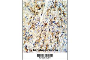 Immunohistochemistry (IHC) image for anti-Cat Eye Syndrome Chromosome Region, Candidate 5 (CECR5) antibody (ABIN2158206)