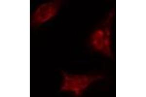 Image no. 1 for anti-TAF5 RNA Polymerase II, TATA Box Binding Protein (TBP)-Associated Factor, 100kDa (TAF5) (Internal Region) antibody (ABIN6259229)