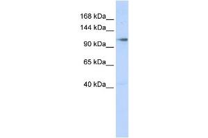 Image no. 1 for anti-Zinc Finger, MIZ-Type Containing 1 (ZMIZ1) (N-Term) antibody (ABIN2781101)