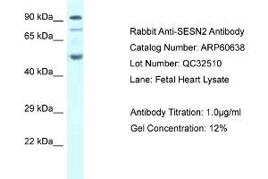 Image no. 1 for anti-Sestrin 2 (SESN2) (C-Term) antibody (ABIN2788518)