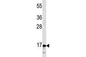 Image no. 2 for anti-Calcitonin-Related Polypeptide alpha (CALCA) (AA 56-84) antibody (ABIN3030254)