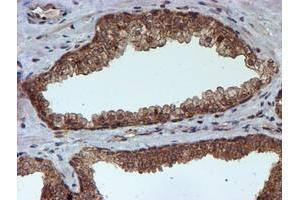Image no. 7 for anti-Histidyl-tRNA Synthetase 2, Mitochondrial (Putative) (HARS2) antibody (ABIN1498584)