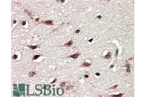 Image no. 1 for anti-Dyslexia Susceptibility 1 Candidate 1 (DYX1C1) (C-Term) antibody (ABIN185356)