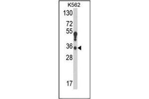 Image no. 3 for anti-Hydroxysteroid (17-Beta) Dehydrogenase 3 (HSD17B3) (AA 96-126), (Middle Region) antibody (ABIN950183)