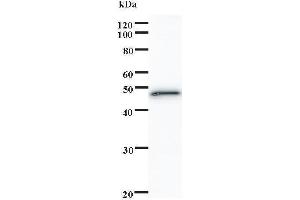 Image no. 1 for anti-SATB Homeobox 1 (SATB1) antibody (ABIN932488)