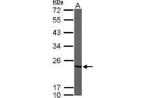 Image no. 1 for anti-Cytidine Monophosphate (UMP-CMP) Kinase 1, Cytosolic (CMPK1) (Center) antibody (ABIN2856126)