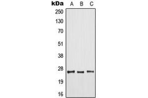 Image no. 1 for anti-ADP-Ribosylation Factor 6 (ARF6) (Center) antibody (ABIN2705503)