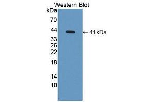 Image no. 1 for anti-Antigen P97 (Melanoma Associated) Identified By Monoclonal Antibodies 133.2 and 96.5 (MFI2) (AA 366-706) antibody (ABIN1869163)