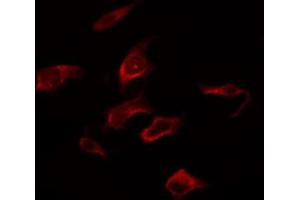 Image no. 1 for anti-V-Raf-1 Murine Leukemia Viral Oncogene Homolog 1 (RAF1) (pSer259) antibody (ABIN6256220)