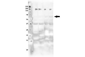 Image no. 3 for anti-Nuclear Receptor Subfamily 4, Group A, Member 2 (NR4A2) (N-Term) antibody (ABIN2780752)