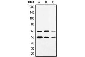Image no. 2 for anti-Synovial Sarcoma Translocation, Chromosome 18 (SS18) (N-Term) antibody (ABIN2707755)