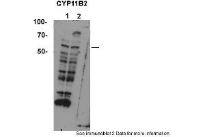 Image no. 2 for anti-Cytochrome P450, Family 11, Subfamily B, Polypeptide 2 (CYP11B2) (Middle Region) antibody (ABIN2776971)